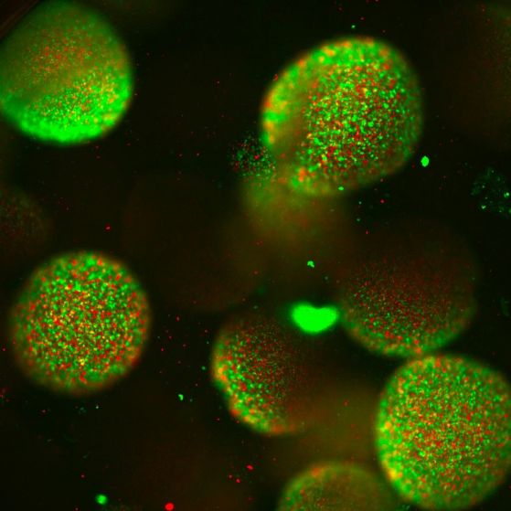 Светещи микроби в зелени сфери