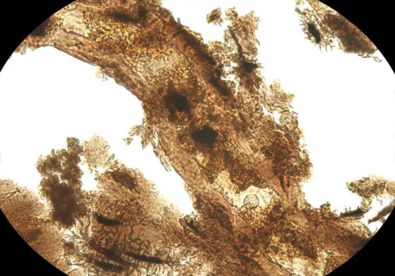 Микроскопски изглед на извлечени меки тъкани от костите на един от екземплярите на динозавър