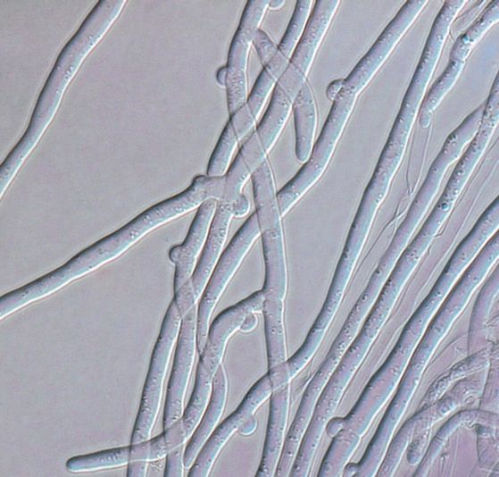 Микроскопско изображение на съединени хифи